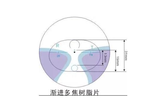 美丽岛多焦镜适合的人群，需要注意的事项